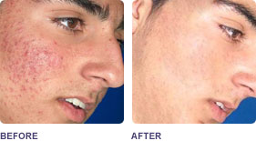 Before and After Photos